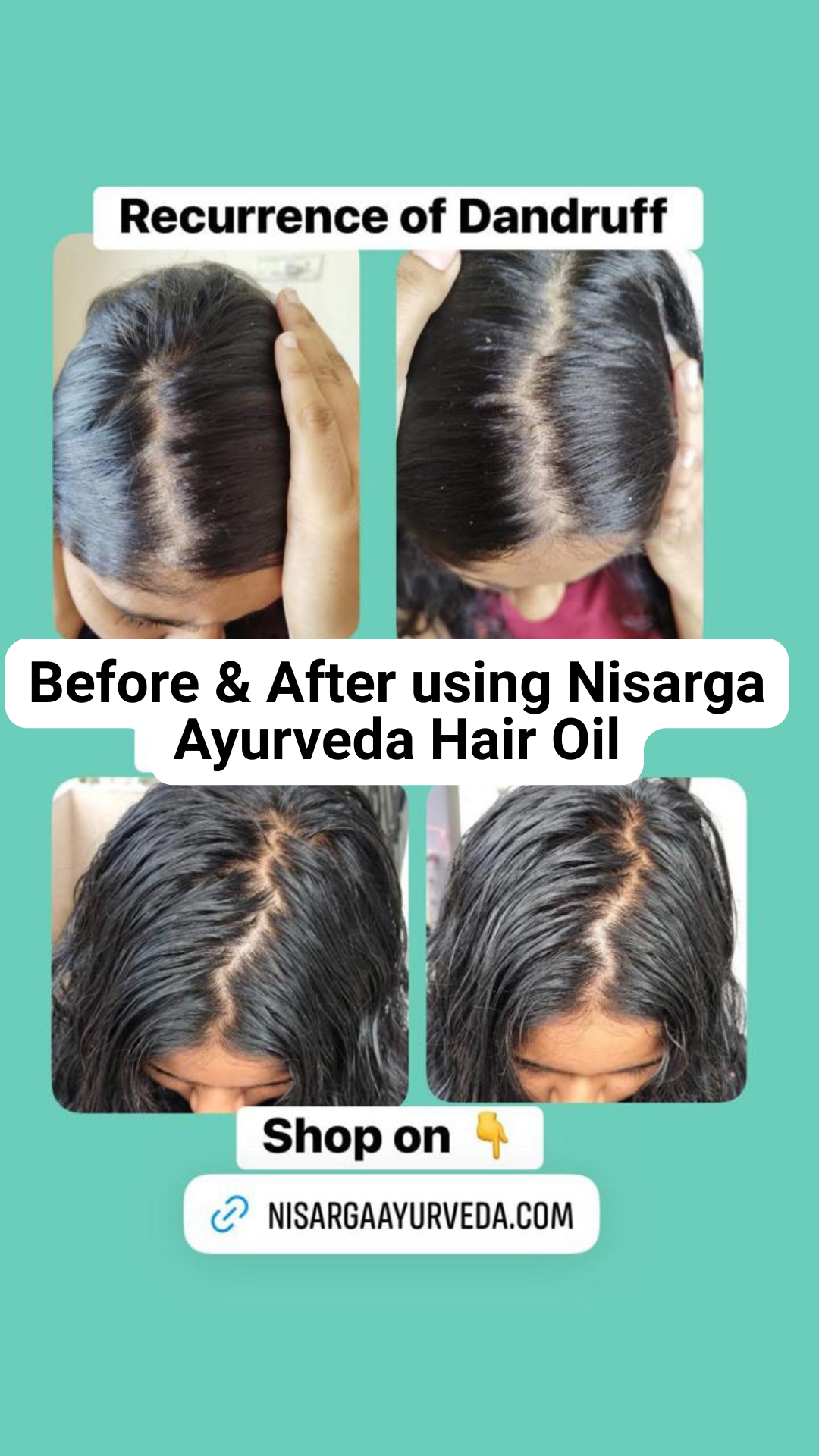 Ayurvedic Hair Oil for Hair Fall control | Hair Nourishment for Men and Women-100ml