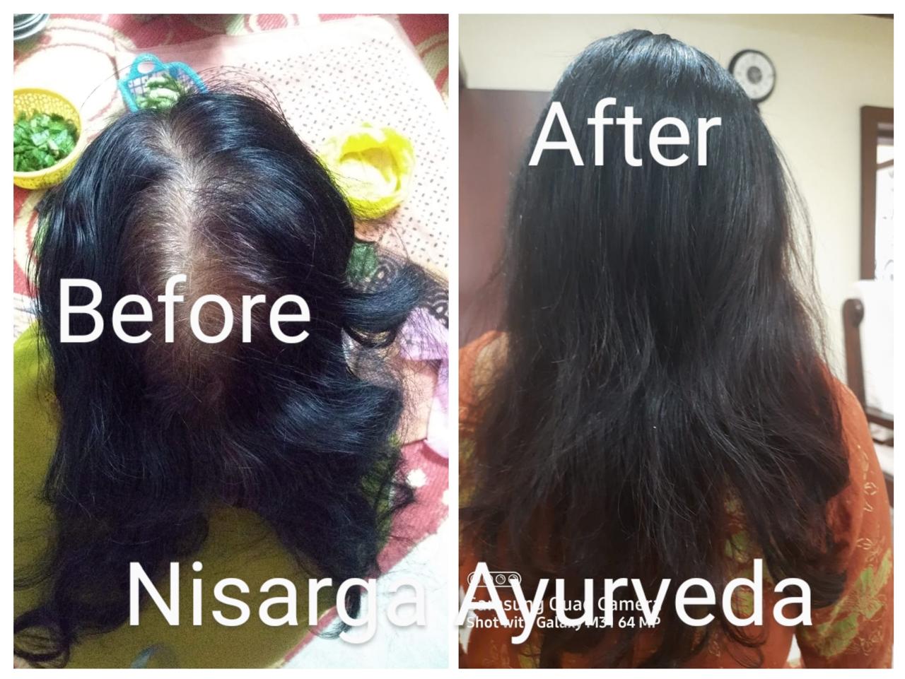 Ayurvedic Hair Oil for Hair Fall control | Hair Nourishment for Men and Women-100ml
